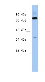 FAM161B Antibody - FAM161B antibody Western blot of THP-1 cell lysate. This image was taken for the unconjugated form of this product. Other forms have not been tested.