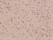 FAM161B Antibody - Immunochemical staining of human FAM161B in human brain with rabbit polyclonal antibody at 1:500 dilution, formalin-fixed paraffin embedded sections.