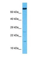 FAM162A / C3orf28 Antibody - Western blot of F162A Antibody with human 786-0 Whole Cell lysate.  This image was taken for the unconjugated form of this product. Other forms have not been tested.