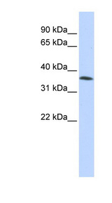 FAM164A / CGI-62 Antibody - FAM164A / CGI-62 antibody Western blot of HepG2 cell lysate. This image was taken for the unconjugated form of this product. Other forms have not been tested.