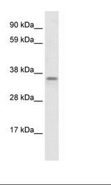 FAM164A / CGI-62 Antibody - Fetal Brain Lysate.  This image was taken for the unconjugated form of this product. Other forms have not been tested.