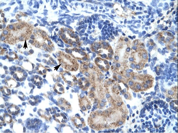 FAM164A / CGI-62 Antibody - FAM164A / CGI-62 antibody ARP32751_T100-NP_057094-CGI-62 Antibody was used in IHC to stain formalin-fixed, paraffin-embedded human kidney.  This image was taken for the unconjugated form of this product. Other forms have not been tested.