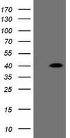 FAM164A / CGI-62 Antibody - HEK293T cells were transfected with the pCMV6-ENTRY control (Left lane) or pCMV6-ENTRY FAM164A (Right lane) cDNA for 48 hrs and lysed. Equivalent amounts of cell lysates (5 ug per lane) were separated by SDS-PAGE and immunoblotted with anti-FAM164A.