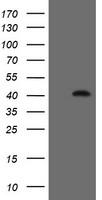 FAM164A / CGI-62 Antibody - HEK293T cells were transfected with the pCMV6-ENTRY control (Left lane) or pCMV6-ENTRY FAM164A (Right lane) cDNA for 48 hrs and lysed. Equivalent amounts of cell lysates (5 ug per lane) were separated by SDS-PAGE and immunoblotted with anti-FAM164A.