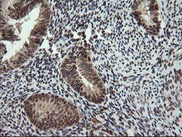FAM164A / CGI-62 Antibody - IHC of paraffin-embedded Human endometrium tissue using anti-FAM164A mouse monoclonal antibody.