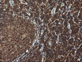 FAM164A / CGI-62 Antibody - IHC of paraffin-embedded Human tonsil using anti-FAM164A mouse monoclonal antibody.