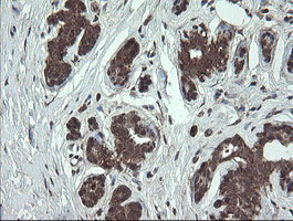 FAM164A / CGI-62 Antibody - IHC of paraffin-embedded Human breast tissue using anti-FAM164A mouse monoclonal antibody.