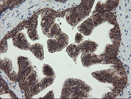 FAM164A / CGI-62 Antibody - IHC of paraffin-embedded Human prostate tissue using anti-FAM164A mouse monoclonal antibody.