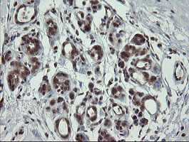 FAM164A / CGI-62 Antibody - IHC of paraffin-embedded Human breast tissue using anti-FAM164A mouse monoclonal antibody.