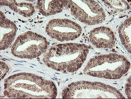 FAM164A / CGI-62 Antibody - IHC of paraffin-embedded Human prostate tissue using anti-FAM164A mouse monoclonal antibody.