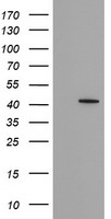 FAM164A / CGI-62 Antibody - HEK293T cells were transfected with the pCMV6-ENTRY control (Left lane) or pCMV6-ENTRY FAM164A (Right lane) cDNA for 48 hrs and lysed. Equivalent amounts of cell lysates (5 ug per lane) were separated by SDS-PAGE and immunoblotted with anti-FAM164A.