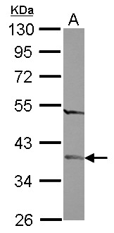 FAM164A / CGI-62 Antibody - Sample (30 ug of whole cell lysate) A: IMR32 10% SDS PAGE FAM164A / CGI-62 antibody diluted at 1:500