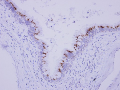 FAM164A / CGI-62 Antibody - IHC of paraffin-embedded Normal breast tubule, using CGI 62 antibody at 1:250 dilution.
