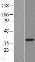 FAM164A / CGI-62 Protein - Western validation with an anti-DDK antibody * L: Control HEK293 lysate R: Over-expression lysate