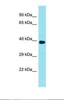 FAM166A Antibody - Western blot of Human Jurkat. FAM166A antibody dilution 1.0 ug/ml.  This image was taken for the unconjugated form of this product. Other forms have not been tested.