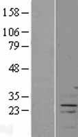 FAM166A Protein - Western validation with an anti-DDK antibody * L: Control HEK293 lysate R: Over-expression lysate