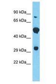 FAM166B Antibody - FAM166B antibody Western Blot of 293T. Antibody dilution: 1 ug/ml.  This image was taken for the unconjugated form of this product. Other forms have not been tested.