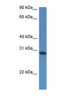 FAM168A Antibody - FAM168A antibody Western blot of Mouse Heart lysate. Antibody concentration 1 ug/ml. This image was taken for the unconjugated form of this product. Other forms have not been tested.