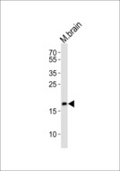 FAM168B Antibody - Western blot of lysate from mouse brain tissue lysate, using FAM168B antibody diluted at 1:1000. A goat anti-rabbit IgG H&L (HRP) at 1:10000 dilution was used as the secondary antibody. Lysate at 20 ug.