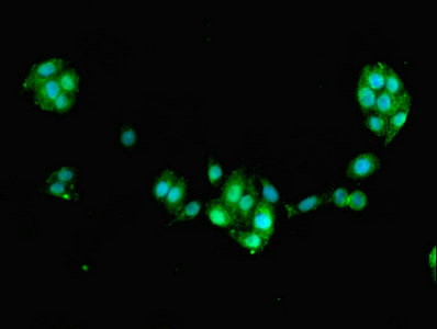 FAM168B Antibody - Immunofluorescent analysis of PC-3 cells using FAM168B Antibody at dilution of 1:100 and Alexa Fluor 488-congugated AffiniPure Goat Anti-Rabbit IgG(H+L)