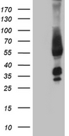 FAM170A Antibody - HEK293T cells were transfected with the pCMV6-ENTRY control. (Left lane) or pCMV6-ENTRY FAM170A. (Right lane) cDNA for 48 hrs and lysed. Equivalent amounts of cell lysates. (5 ug per lane) were separated by SDS-PAGE and immunoblotted with anti-FAM170A. (1:2000)