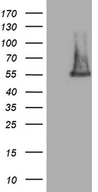 FAM170A Antibody - HEK293T cells were transfected with the pCMV6-ENTRY control. (Left lane) or pCMV6-ENTRY FAM170A. (Right lane) cDNA for 48 hrs and lysed