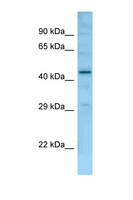 FAM170B Antibody - Fam170b antibody Western blot of Mouse Liver lysate. Antibody concentration 1 ug/ml.  This image was taken for the unconjugated form of this product. Other forms have not been tested.