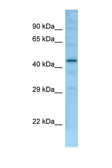 FAM170B Antibody - Fam170b antibody Western blot of Mouse Liver lysate. Antibody concentration 1 ug/ml.  This image was taken for the unconjugated form of this product. Other forms have not been tested.