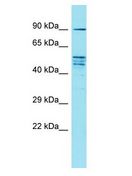 FAM171A2 Antibody - FAM171A2 antibody Western Blot of HeLa. Antibody dilution: 1 ug/ml.  This image was taken for the unconjugated form of this product. Other forms have not been tested.
