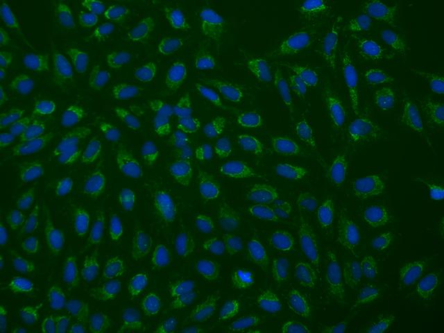 FAM171B Antibody - Immunofluorescence staining of FAM171B in U2OS cells. Cells were fixed with 4% PFA, permeabilzed with 0.1% Triton X-100 in PBS, blocked with 10% serum, and incubated with rabbit anti-Human FAM171B polyclonal antibody (dilution ratio 1:200) at 4°C overnight. Then cells were stained with the Alexa Fluor 488-conjugated Goat Anti-rabbit IgG secondary antibody (green) and counterstained with DAPI (blue). Positive staining was localized to Cytoplasm.