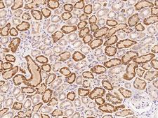 FAM173A Antibody - Immunochemical staining of human FAM173A in human kidney with rabbit polyclonal antibody at 1:100 dilution, formalin-fixed paraffin embedded sections.