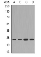 FAM173B Antibody - Western blot analysis of FAM173B expression in A549 (A); mouse liver (B); mouse heart (C); rat brain (D) whole cell lysates.