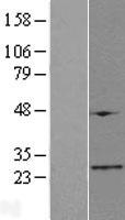 FAM173B Protein - Western validation with an anti-DDK antibody * L: Control HEK293 lysate R: Over-expression lysate