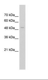 FAM174B Antibody - Jurkat Cell Lysate.  This image was taken for the unconjugated form of this product. Other forms have not been tested.