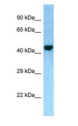 FAM175A / CCDC98 Antibody - FAM175A / CCDC98 antibody Western Blot of 293T cell lysate.  This image was taken for the unconjugated form of this product. Other forms have not been tested.
