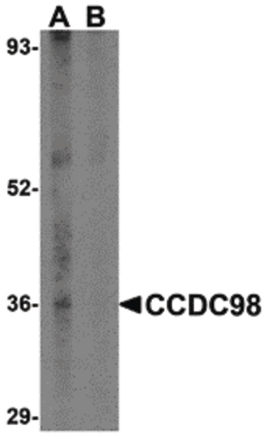 FAM175A / CCDC98 Antibody - Western blot of CCDC98 in human breast tissue lysate in (A) the absence and (B) presence of blocking peptide with CCDC98 antibody at 1 ug/ml.