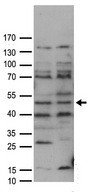 FAM175A / CCDC98 Antibody - HEK293T cells were transfected with the pCMV6-ENTRY control. (Left lane) or pCMV6-ENTRY FAM175A. (Right lane) cDNA for 48 hrs and lysed