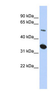 FAM175B / KIAA0157 Antibody - FAM175B antibody western blot of HepG2 cell lysate.  This image was taken for the unconjugated form of this product. Other forms have not been tested.