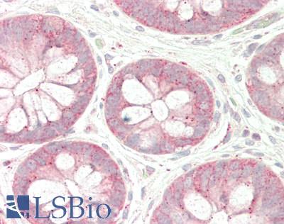 FAM175B / KIAA0157 Antibody - Human Colon: Formalin-Fixed, Paraffin-Embedded (FFPE)