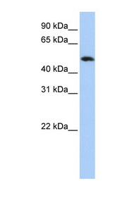 FAM175B / KIAA0157 Antibody - FAM175B antibody Western blot of HepG2 cell lysate. This image was taken for the unconjugated form of this product. Other forms have not been tested.
