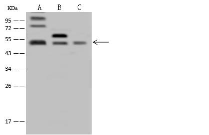 FAM175B / KIAA0157 Antibody - Anti-FAM175B rabbit polyclonal antibody at 1:500 dilution. Lane A: U-251 MG Whole Cell Lysate. Lane B: NIH-3T3 Whole Cell Lysate. Lane C: HepG2 Whole Cell Lysate. Lysates/proteins at 30 ug per lane. Secondary: Goat Anti-Rabbit IgG (H+L)/HRP at 1/10000 dilution. Developed using the ECL technique. Performed under reducing conditions. Predicted band size: 47 kDa. Observed band size: 50 kDa.