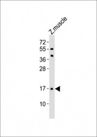 FAM176A / TMEM166 Antibody - Anti- (DANRE) Eva1a Antibody at 1:1000 dilution + zebrafish muscle lysates Lysates/proteins at 20 ug per lane. Secondary Goat Anti-Rabbit IgG, (H+L), Peroxidase conjugated at 1/10000 dilution Predicted band size : 17 kDa Blocking/Dilution buffer: 5% NFDM/TBST.