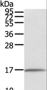 FAM176A / TMEM166 Antibody - Western blot analysis of Human normal liver tissue, using EVA1A Polyclonal Antibody at dilution of 1:550.