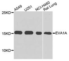 FAM176A / TMEM166 Antibody - Western blot analysis of extracts of various cell lines.