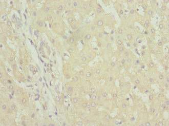 FAM176A / TMEM166 Antibody - Immunohistochemistry of paraffin-embedded human liver tissue at dilution 1:100