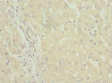 FAM176A / TMEM166 Antibody - Immunohistochemistry of paraffin-embedded human liver tissue at dilution 1:100