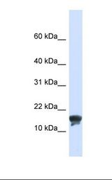 FAM176A / TMEM166 Antibody - 293T cell lysate. Antibody concentration: 1.0 ug/ml. Gel concentration: 10-20%.  This image was taken for the unconjugated form of this product. Other forms have not been tested.