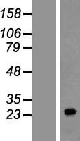 FAM177A1 Protein - Western validation with an anti-DDK antibody * L: Control HEK293 lysate R: Over-expression lysate