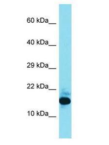 FAM177B Antibody - FAM177B antibody Western Blot of 721_B. Antibody dilution: 1 ug/ml.  This image was taken for the unconjugated form of this product. Other forms have not been tested.