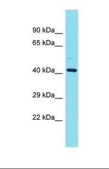 FAM181B Antibody - Western blot of Placenta. FAM181B antibody dilution 1.0 ug/ml.  This image was taken for the unconjugated form of this product. Other forms have not been tested.